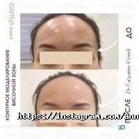 Частные клиники Anna Vi Clinics  фото
