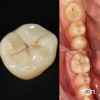 відгуки про Стоматологія Вербіцького фото