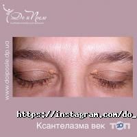 До и После отзывы фото