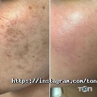 Tone відгуки фото