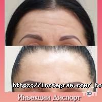 Top Laser відгуки фото