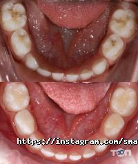 Smaga відгуки фото