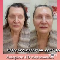 Top Laser, центр естетики фото
