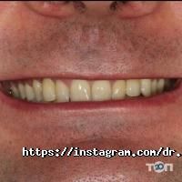 відгуки про Борденталь фото