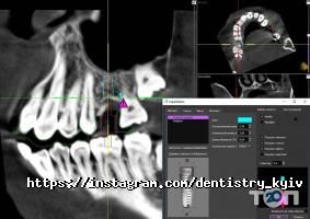 Стоматологія на Петрівці відгуки фото