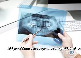 отзывы о Phil Dent фото