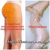 New U відгуки фото