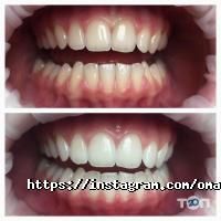 Omax Dental Care Дніпро фото