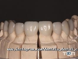 Дентея, стоматологія фото
