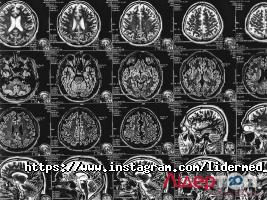 Лідермед відгуки фото