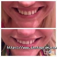 Lys Royal Київ фото