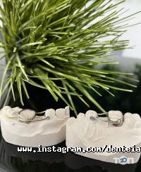 Дентея Івано-Франківськ фото