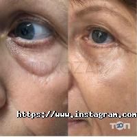 Перлина відгуки фото