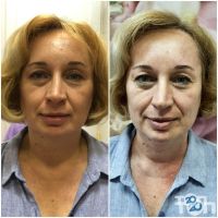 Elitcosmo Харків відгуки Elitcosmo Харків відгуки фото