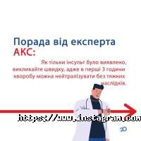 Акс відгуки фото