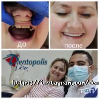 Стоматології Dentopolis фото