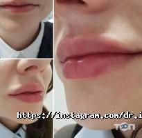 відгуки про Bianko фото