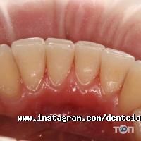 відгуки про Дентея фото