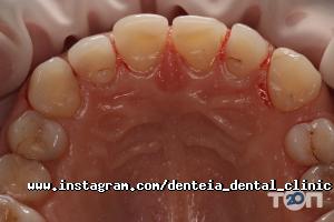 Стоматології Дентея фото