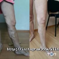 Лекарь відгуки фото