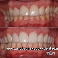 Дентея, стоматологія фото
