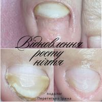 відгуки про Foot Control фото