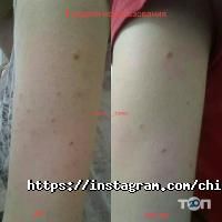 отзывы о Магазин ортопедических стелек фото