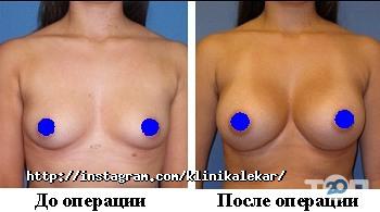 Лекарь Запоріжжя фото