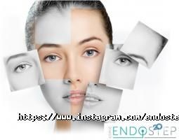 Endostep Київ фото