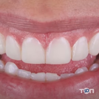 Dr Dent 32, стоматология фото