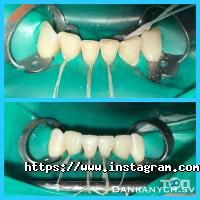 відгуки про Dentis Line фото