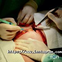 відгуки про Endostep фото