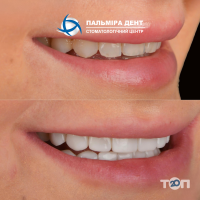 компания Пальмира Дент фото