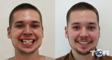 HappyDent, стоматологія - фото 8