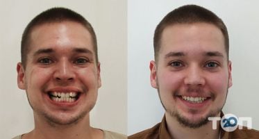 HappyDent, стоматологія - фото 10