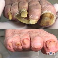 відгуки про Подолог Здорова Стопа фото