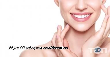 Венеція відгуки фото