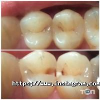 відгуки про Dentis Line фото