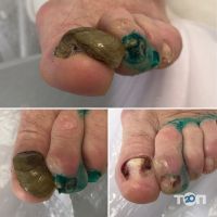 Подолог Здорова Стопа, клініка - фото 8