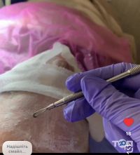 відгуки про Best фото