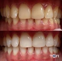 Via Stom, стоматологічна клініка - фото 9