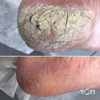 компанія Подолог Здорова Стопа фото