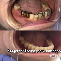 Студія стоматології Данилевського Дніпро фото