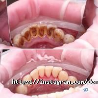 відгуки про Dental Clinic фото