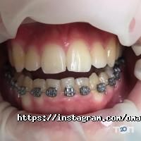 Omax Dental Care відгуки фото