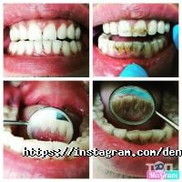 Dental Center Алматы фото
