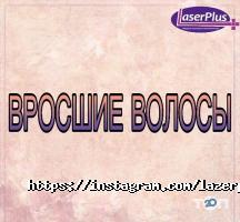 Lazerрlus Київ фото