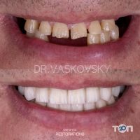 відгуки про Jvdental фото
