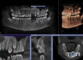 3D Діагностика, центр комп'ютерної томографії фото