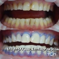 Стоматологии White Dent фото